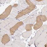 MYH6 Antibody in Immunohistochemistry (Paraffin) (IHC (P))