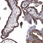 FES Antibody in Immunohistochemistry (Paraffin) (IHC (P))