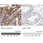 Adenosine Deaminase Antibody in Immunohistochemistry (IHC)