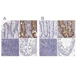 Adenosine Deaminase Antibody in Immunohistochemistry (IHC)