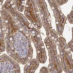 Adenosine Deaminase Antibody in Immunohistochemistry (IHC)