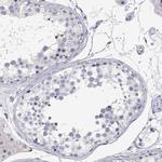 Adenosine Deaminase Antibody in Immunohistochemistry (IHC)