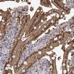 Adenosine Deaminase Antibody in Immunohistochemistry (IHC)