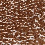 PACS2 Antibody in Immunohistochemistry (Paraffin) (IHC (P))