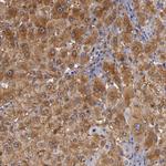 ZNF229 Antibody in Immunohistochemistry (Paraffin) (IHC (P))