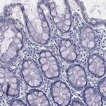 alpha-1 Microglobulin Antibody in Immunohistochemistry (Paraffin) (IHC (P))