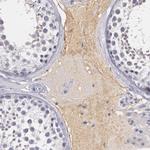 alpha-1 Microglobulin Antibody in Immunohistochemistry (Paraffin) (IHC (P))