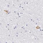 Fetuin A Antibody in Immunohistochemistry (IHC)