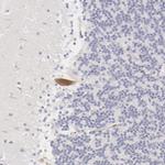 Fetuin A Antibody in Immunohistochemistry (IHC)