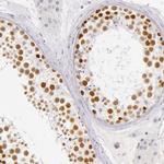 RBMY1A1 Antibody in Immunohistochemistry (IHC)