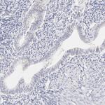 Carbonic Anhydrase II Antibody in Immunohistochemistry (Paraffin) (IHC (P))