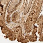 Carbonic Anhydrase II Antibody in Immunohistochemistry (Paraffin) (IHC (P))