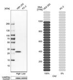 Carbonic Anhydrase II Antibody in Western Blot (WB)