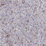 Fibulin 1 Antibody in Immunohistochemistry (IHC)