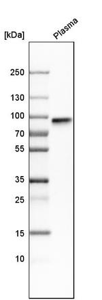 Fibulin 1 Antibody in Western Blot (WB)