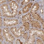 ZNF234 Antibody in Immunohistochemistry (Paraffin) (IHC (P))