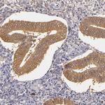 TOM1 Antibody in Immunohistochemistry (IHC)