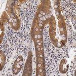 TOM1 Antibody in Immunohistochemistry (IHC)