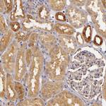 TOM1 Antibody in Immunohistochemistry (IHC)