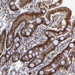 RREB1 Antibody in Immunohistochemistry (Paraffin) (IHC (P))