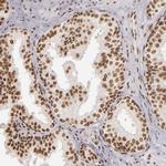 PAPOLA Antibody in Immunohistochemistry (Paraffin) (IHC (P))