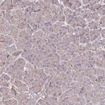 ZNF268 Antibody in Immunohistochemistry (Paraffin) (IHC (P))