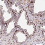 ZNF268 Antibody in Immunohistochemistry (Paraffin) (IHC (P))