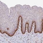 ZNF268 Antibody in Immunohistochemistry (Paraffin) (IHC (P))