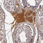 Complement Factor B Antibody in Immunohistochemistry (Paraffin) (IHC (P))