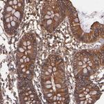 TMOD3 Antibody in Immunohistochemistry (Paraffin) (IHC (P))