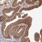 TMOD3 Antibody in Immunohistochemistry (IHC)