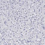 PRX Antibody in Immunohistochemistry (Paraffin) (IHC (P))