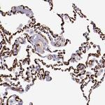 PRX Antibody in Immunohistochemistry (Paraffin) (IHC (P))