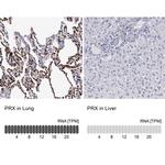 PRX Antibody in Immunohistochemistry (IHC)