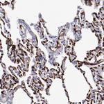 PRX Antibody in Immunohistochemistry (IHC)