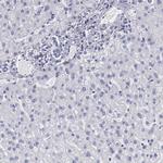 PRX Antibody in Immunohistochemistry (IHC)