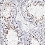 ODF2 Antibody in Immunohistochemistry (Paraffin) (IHC (P))