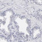 ODF2 Antibody in Immunohistochemistry (IHC)