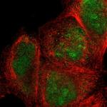 SIX1 Antibody in Immunocytochemistry (ICC/IF)