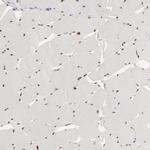 SIX1 Antibody in Immunohistochemistry (IHC)