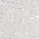 SIX1 Antibody in Immunohistochemistry (IHC)