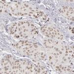 SIX1 Antibody in Immunohistochemistry (IHC)