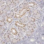 SIX1 Antibody in Immunohistochemistry (IHC)