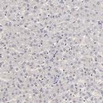 SIX1 Antibody in Immunohistochemistry (IHC)