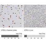 ATRX Antibody