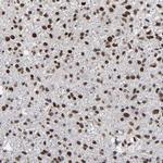 ATRX Antibody in Immunohistochemistry (IHC)