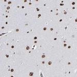 ATRX Antibody in Immunohistochemistry (IHC)