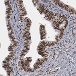 ATRX Antibody in Immunohistochemistry (IHC)