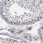 ATRX Antibody in Immunohistochemistry (IHC)