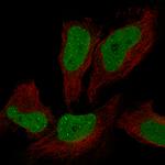 ATRX Antibody in Immunocytochemistry (ICC/IF)